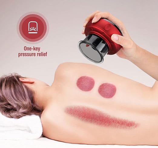 Electric Cupping Device