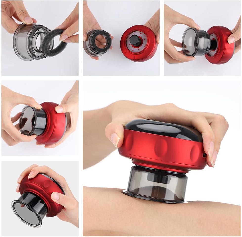 Electric Cupping Device